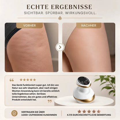 Cellusmooth EMS Anti-Cellulite-Massagegerät