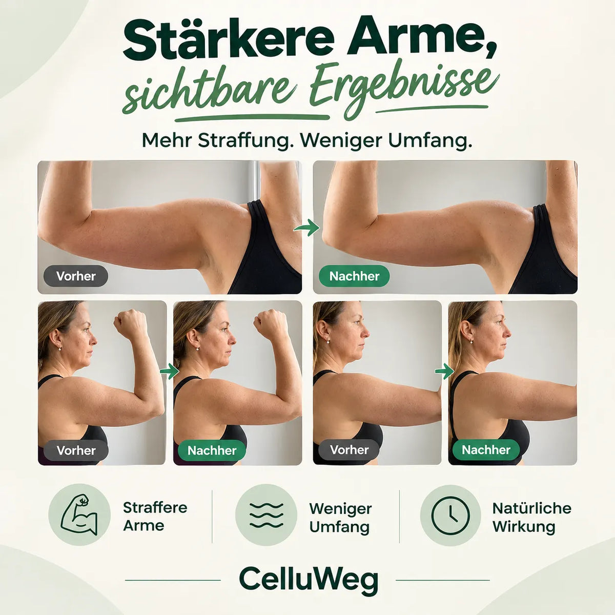 Formende Armstulpen
