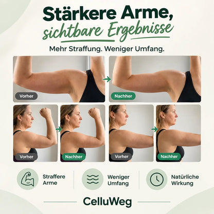 Formende Armstulpen
